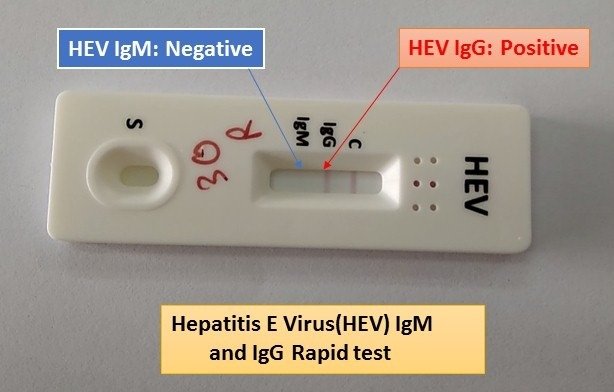HEPATITIS E VIRUS ANTIBODY IGM(HEVM) RAPID TEST